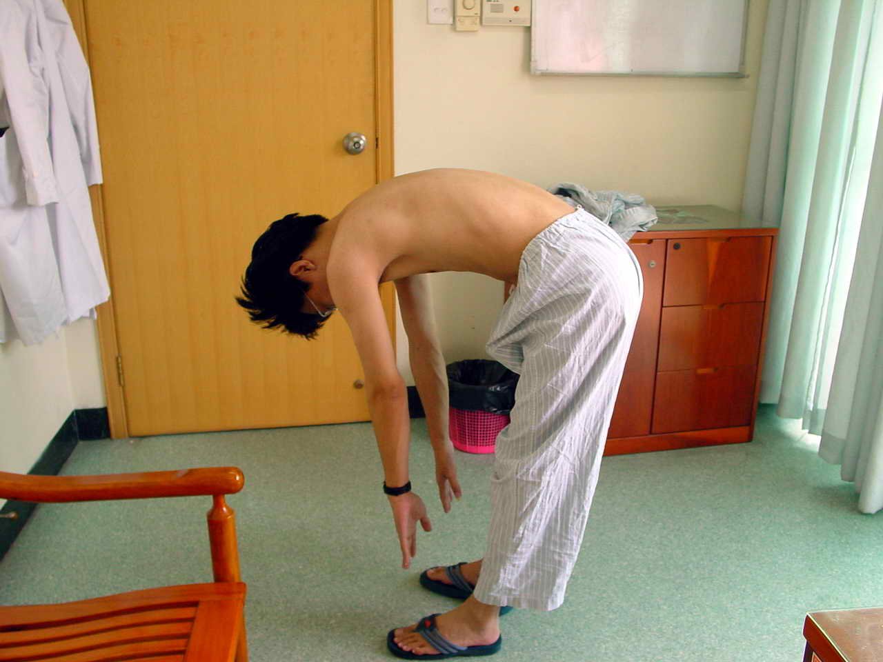 强直性脊柱炎中期的症状表现