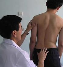 教你自己诊断强直性脊柱炎 教你自己诊断强直性脊柱炎