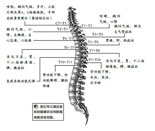 止痛药对强制性脊柱炎有无治疗 止痛药对强制性脊柱炎有无治疗