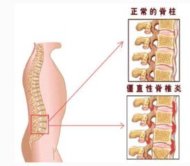 强直：这个动作危害你的健康，别再做了